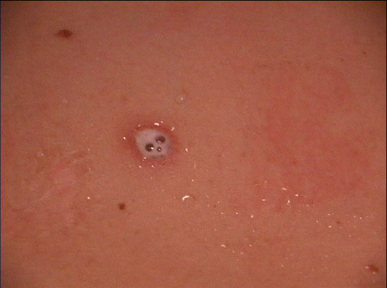 Skull Scar